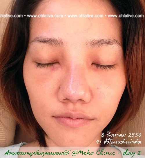 day 2 - 8 สิงหาคม ช่วงกลางวัน