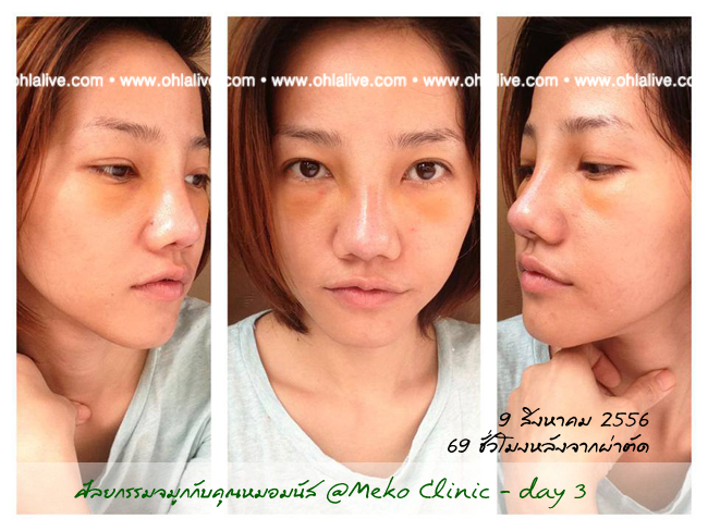 day3 - 9 สิงหาคม 69ชั่วโมง