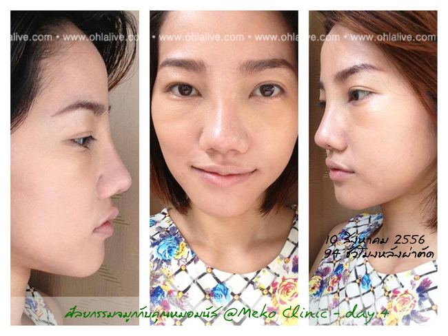 day4 94ชั่วโมง