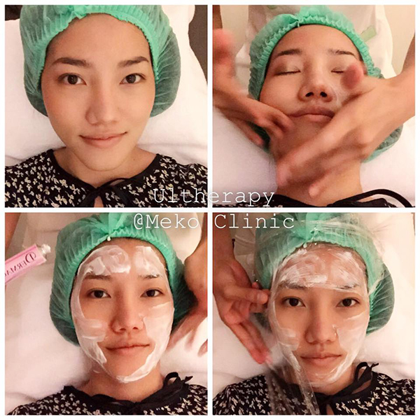 meko-clinic-ulthera-0