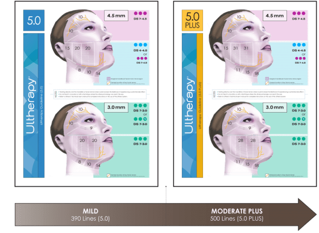 ulthera-diagram-line